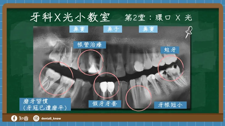 牙科 X 光小教室 第2堂：環口 X 光