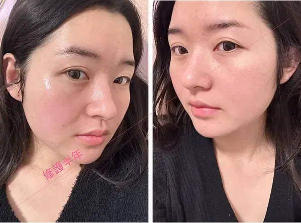 ATLA肌密青春原液使用前後對比
