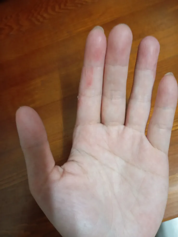 充滿印記的左手