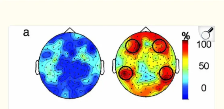 左為平常人，又為僧侶冥想時的腦部伽瑪波強度圖。取自文獻2．