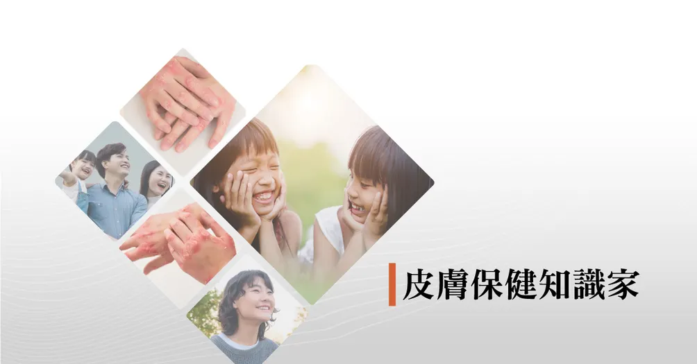 異位性皮膚炎保健專家_絲聚蛋白