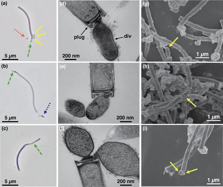黏附在甲烷古菌上的迷你細菌。圖片取自期刊