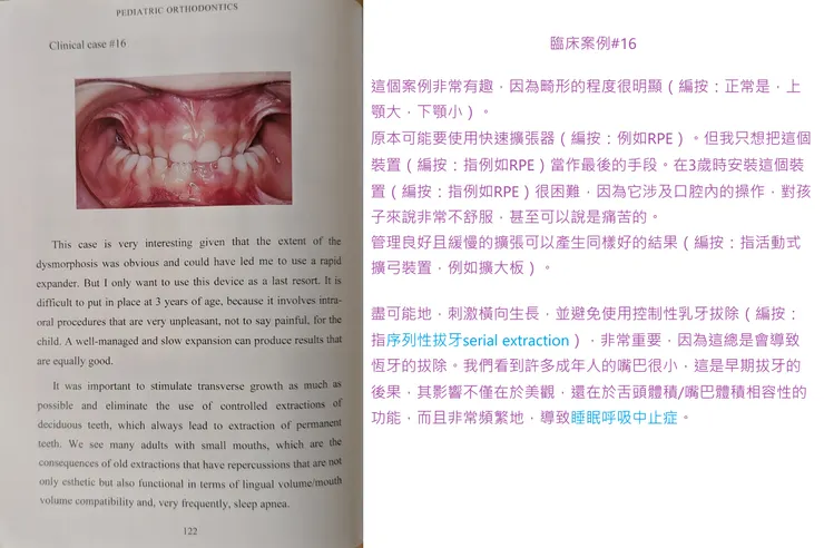 法國醫師的書（書名Pediatric Orthodontics  Easy as Pie在圖片上方），台灣有在賣，可按下點選