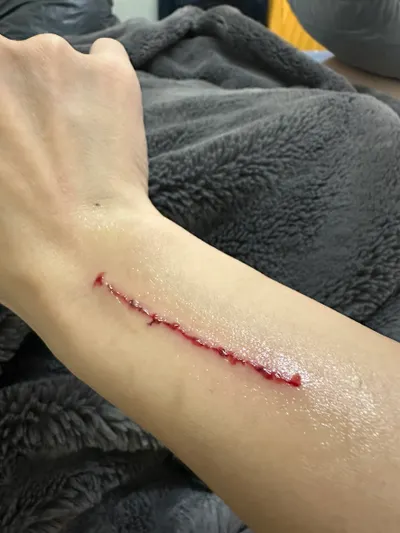 獸性大發後，突然懂了結紮不是殘忍，是種無奈而必要的生存方式