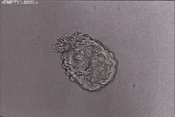 胚胎等級：HHB FAB Day6