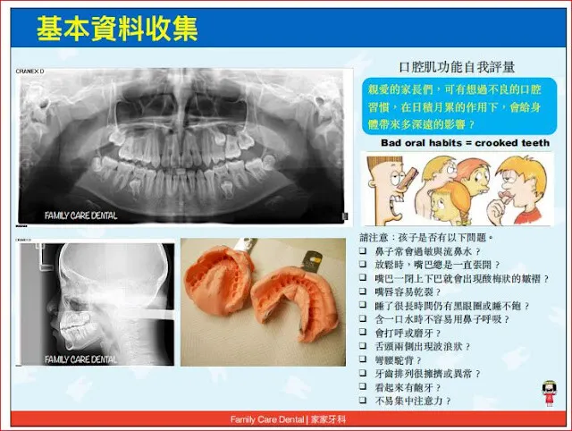 我現在已不傳統印模，用數位口掃替代