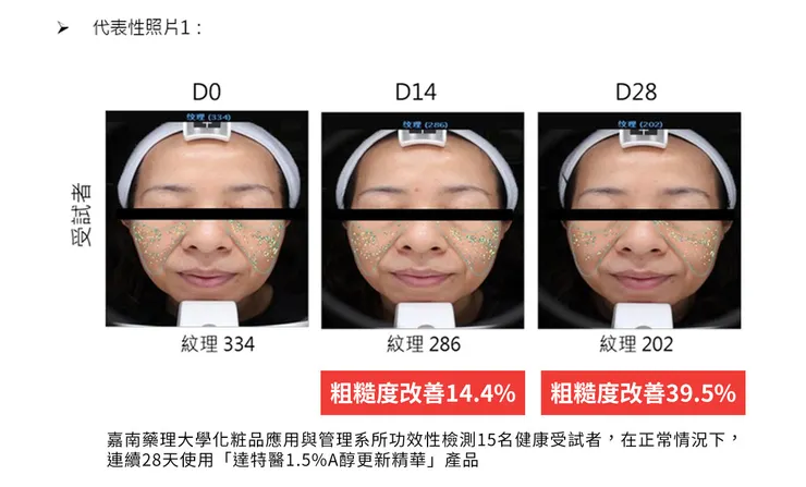 「A醇」現代抗老神器！