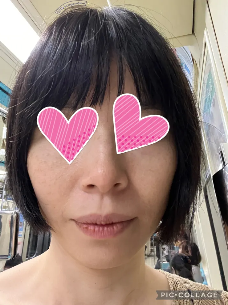 0修圖帶妝14小時這狀態已經很不錯了。老女人鬆垮的法令紋靠化妝改善還是有限。