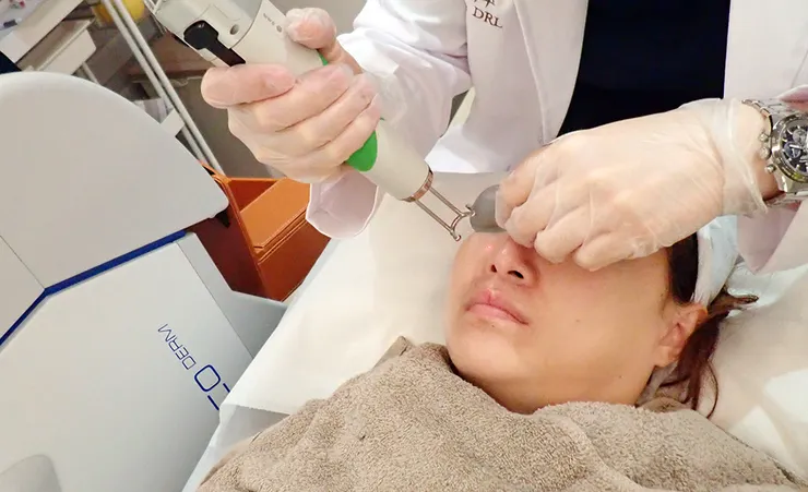 台北打皮秒│探索皮秒+蜂巢(超級鏡片ReFIX)-台北醫美診所推薦