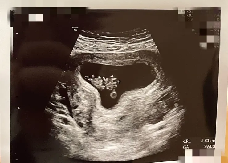 最底部小圓圓處是便當盒啊：）