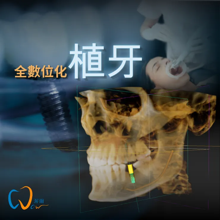 重拾自信笑容的關鍵選擇：科技渥爾牙醫診所，打造精準、安全、舒適的數位植牙！