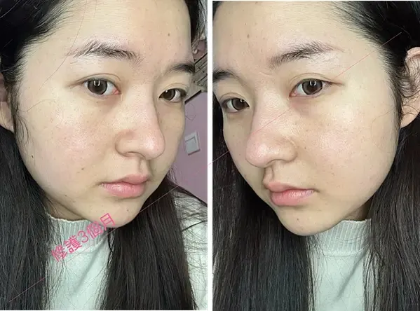 ATLA肌密青春原液使用前後對比