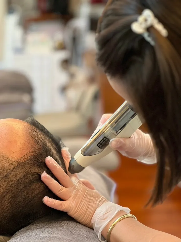 台南美容課程【柔星國際美容教育】毛母開通外泌體御髮教學│養髮