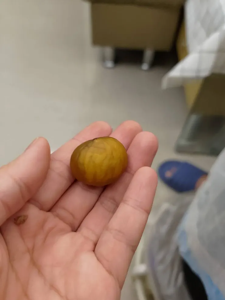 作者拍攝的完整栗子