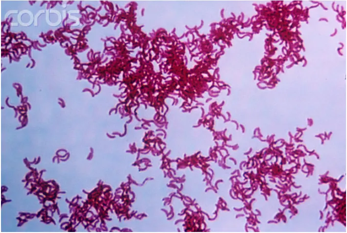 紅螺菌。圖片取自維基百科