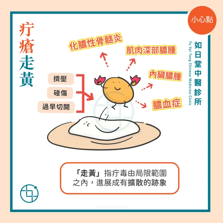 擠壓疔瘡可能會造成膿血症或蜂窩性組織炎