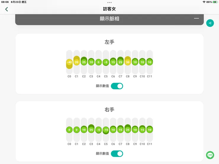 圖二：一位30歲長年皮膚問題的脈像