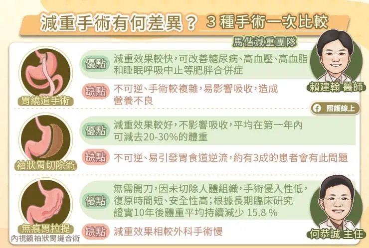 減重手術有何差異