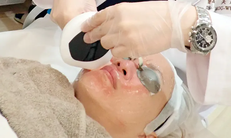 台北打皮秒│探索皮秒+蜂巢(超級鏡片ReFIX)-台北醫美診所推薦