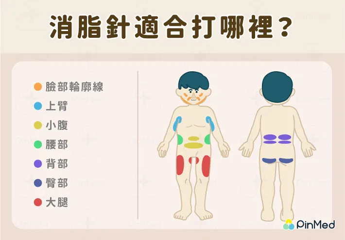 消脂針適合打哪裡？
