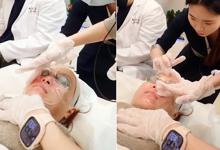 台北打皮秒│探索皮秒+蜂巢(超級鏡片ReFIX)-台北醫美診所推薦