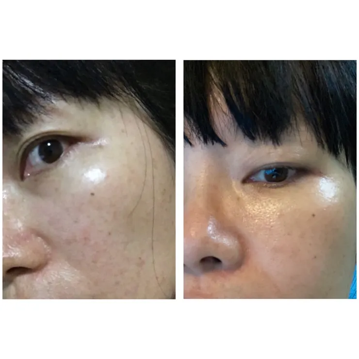 左:2023/6/4 | 右:2023/12/4