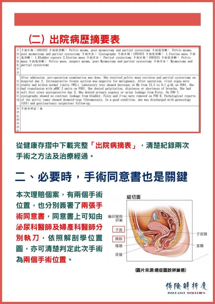 從健康存摺中下載完整「出院病摘表」，清楚紀錄兩次手術之方法及治療經過。本次理賠個案，有兩個手術位置，也分別簽署了兩張手術同意書，同意書上可知由泌尿科醫師及婦產科醫師分別執刀，依照解剖學位置圖，亦可清楚判定此次手術為兩個手術位置。