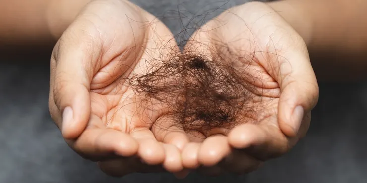 別讓禿頭擊垮自信！掌握掉髮前兆、預防與治療關鍵，重拾茂密秀髮！