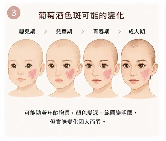 葡萄酒色斑的可能變話化