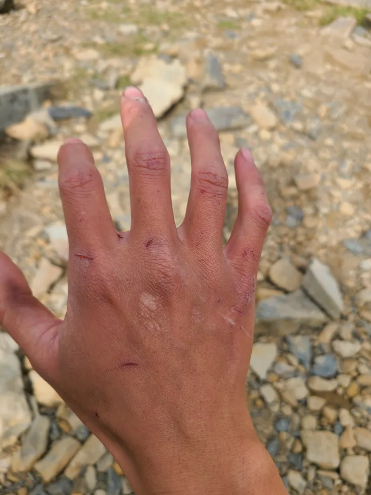 紀錄一下，前兩天和箭竹搏鬥的雙手