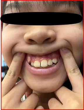 可特別針對想強調的地方特寫，例如小虎牙