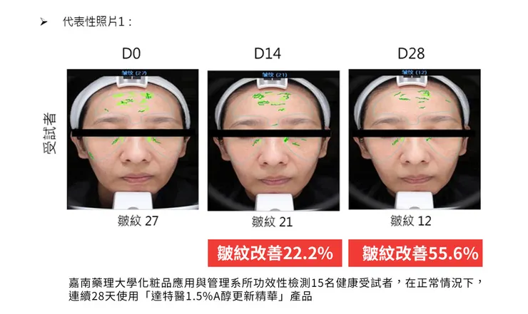 「A醇」現代抗老神器！