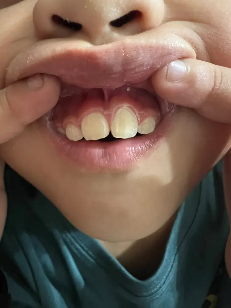 2025/04/03媽媽照弟弟的現狀給我看