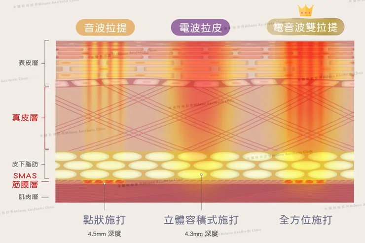 電音雙波拉提黃金組合