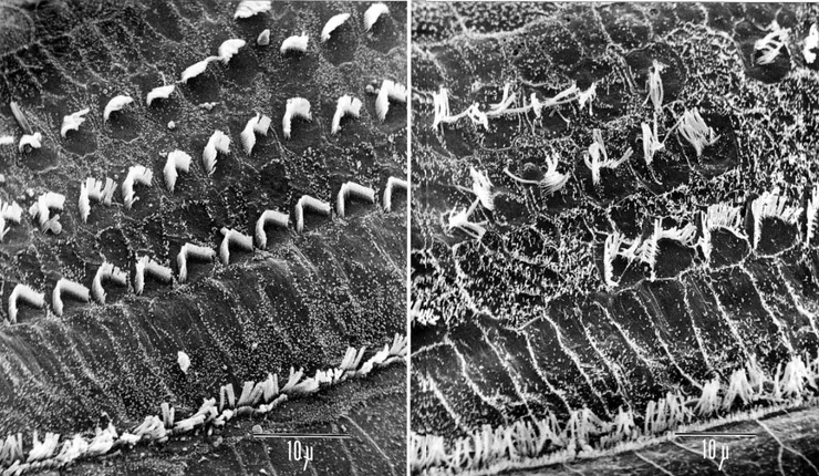 未受損毛細胞/受損毛細胞