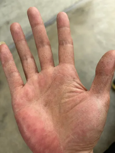 攤開妳的掌心，讓我看看妳