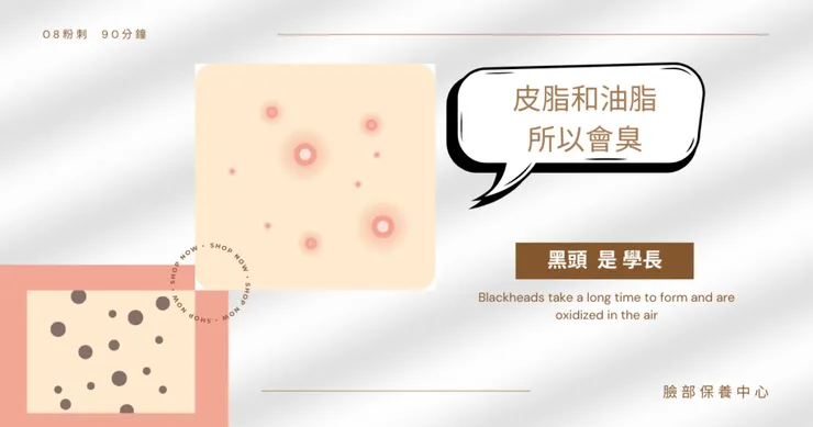 粉刺會臭/清粉刺/除粉刺