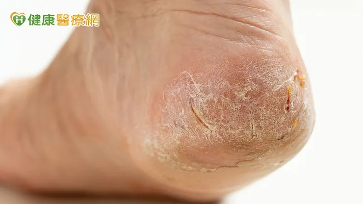 造成皮膚乾燥的原因相當多元，包含年齡增長、遺傳體質、營養不均衡（如維生素缺乏）、生活作息不規律（熬夜、喝水不足）、長期壓力，以及賀爾蒙變化（如男女更年期）等。