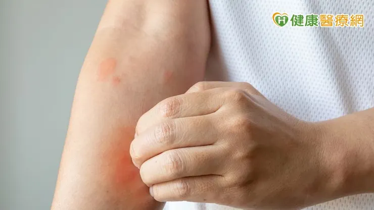 皮膚乾燥是冬季常見的皮膚問題，主要與表皮屏障受損、角質層水分流失有關。