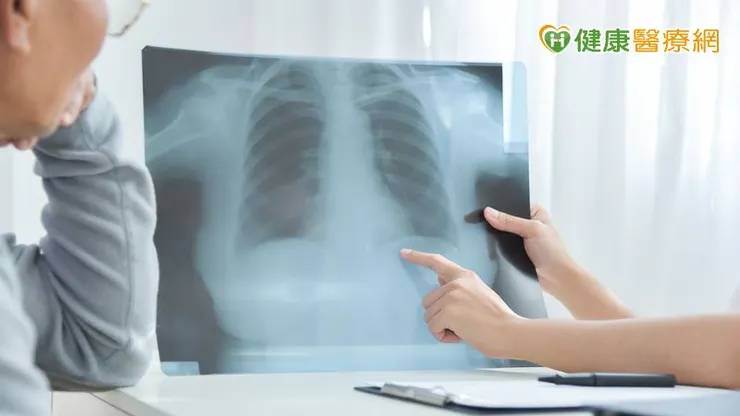 臺灣肺癌病人約90%屬於非小細胞肺癌，當中七成左右是肺腺癌，容易產生關鍵突變，這往往是誘發病人產生腫瘤的起因。