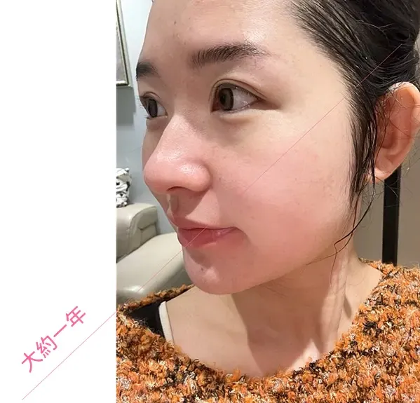 ATLA肌密青春原液效果如何