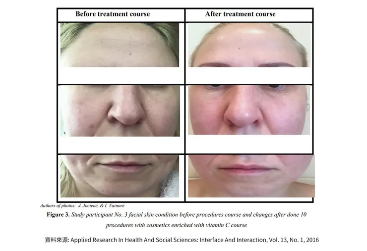 早C晚A 誰重要？兩大時機深入挑戰「早C好處」的保養計畫