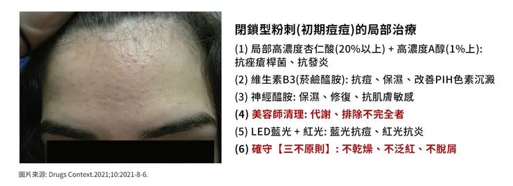 悶痘長不停怎麼辦?