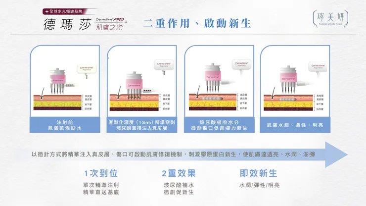 逆轉肌齡的「逆時針」美學!酷捷+水光雙強聯手,毛孔凹疤消失、肌膚透出玻璃光!