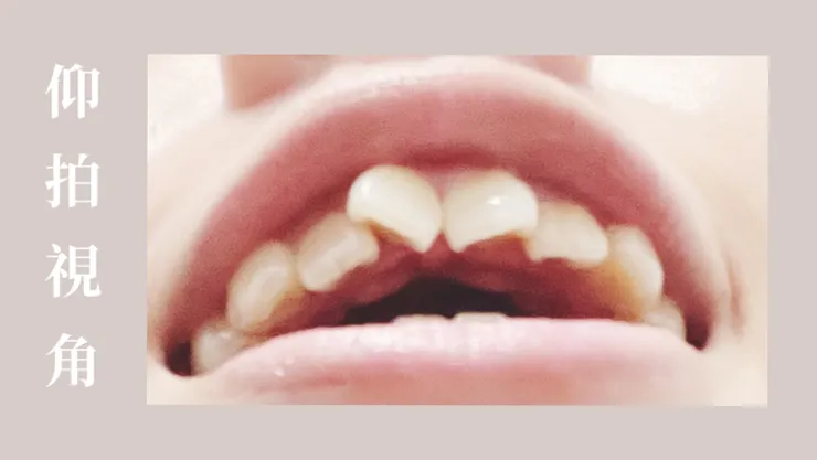 讓我很在意的蝴蝶牙