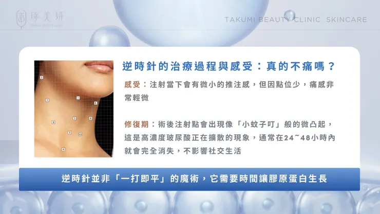 視覺年齡的「無聲殺手」：告別火雞脖，用「逆時針 Profhilo」找回緊緻天鵝頸！