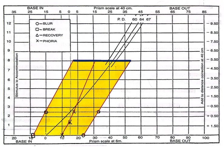雙眼視機能異常 診斷與治療 第二版—陳振豪OD