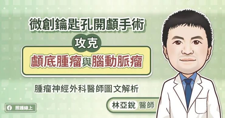 微創鑰匙孔開顱手術攻克顱底腫瘤與腦動脈瘤，腫瘤神經外科醫師圖文解析