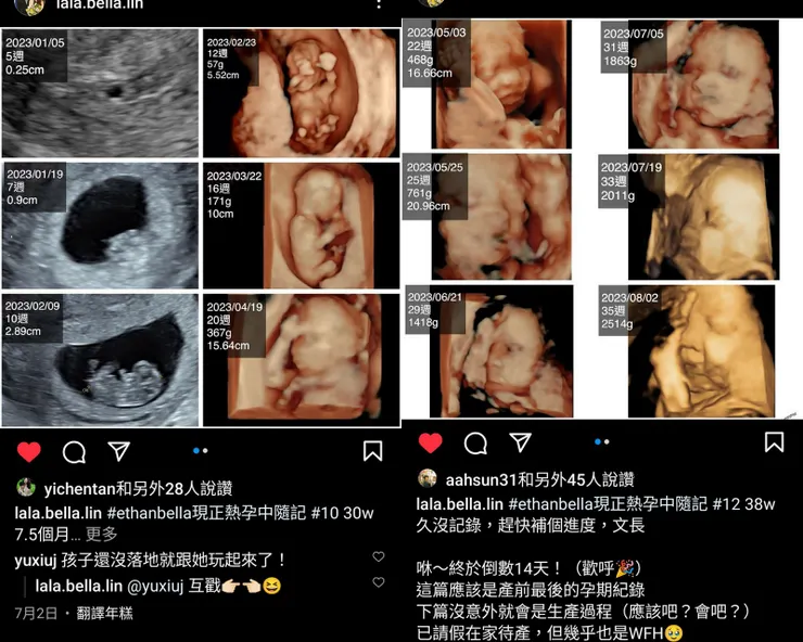 【妳零歲的腹中傳記已獲得無數點 閱！拉拉在Instagram的現正熱孕中記錄了懷胎期間身心變化、感受種種。】