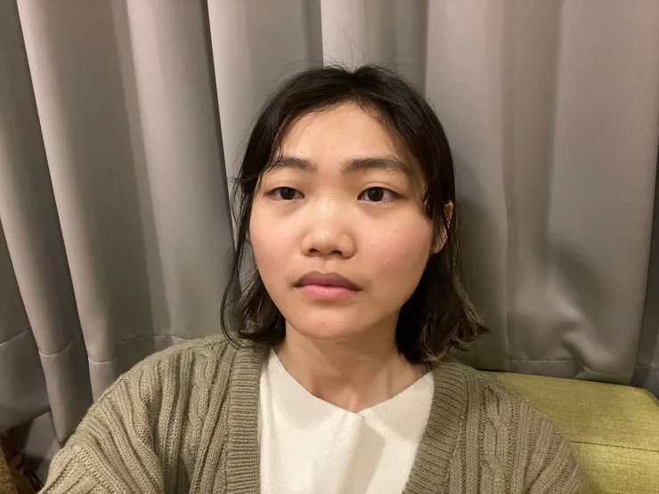 點上眼睛的麻醉藥水（圖源：筆者）